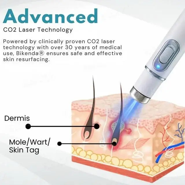 [⚡️BEST DEAL TODAY]🔥Non-Invasive Mole and Wart Removal Laser Pen
