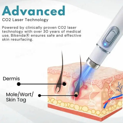 [⚡️BEST DEAL TODAY]🔥Non-Invasive Mole and Wart Removal Laser Pen